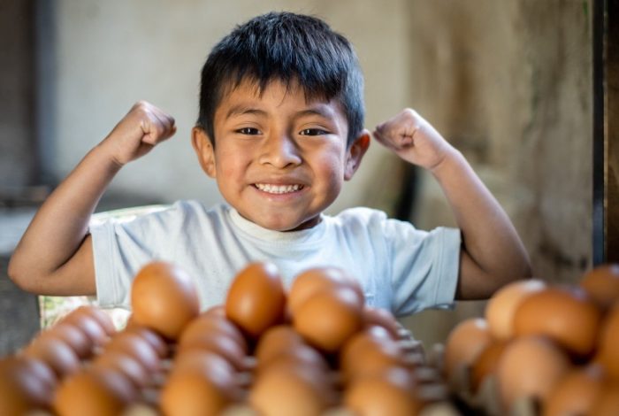 ¿Qué es la malnutrición y cómo afecta a la niñez de Guatemala? - World Vision Guatemala